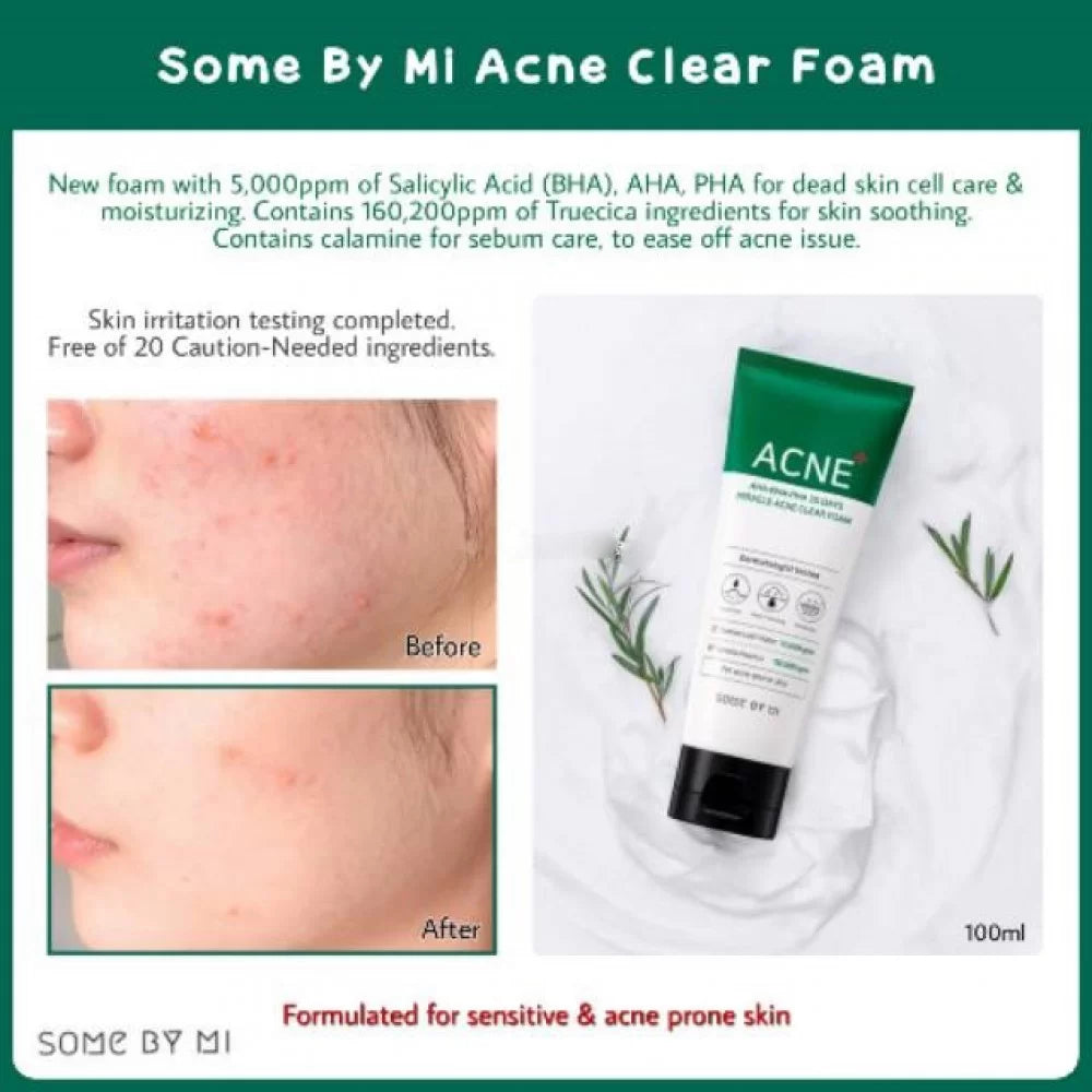 SOME BY MI - Miracle Acne Clear Foam - 100ml - Ministry of Skin